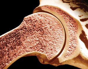 Red and yellow bone marrow: anatomy, where it is located in humans, functions and histology, as well as healthy foods